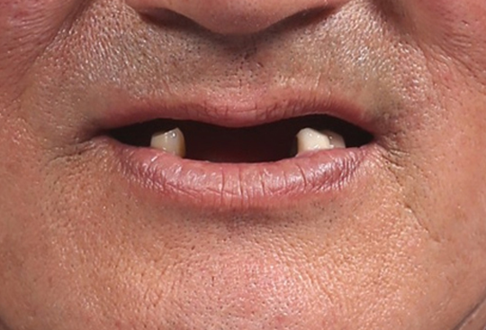 e15f0d4526b42ab0194c20ceefe2d6f6_1733907460_5693.png