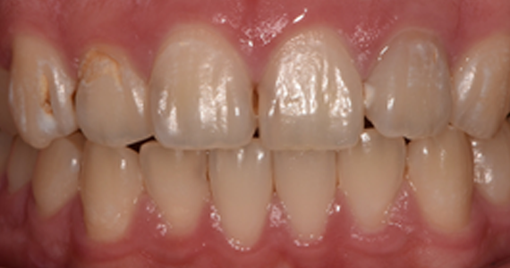 case2-1