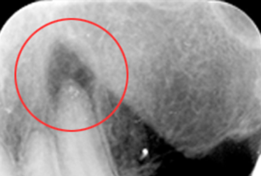 case2-1